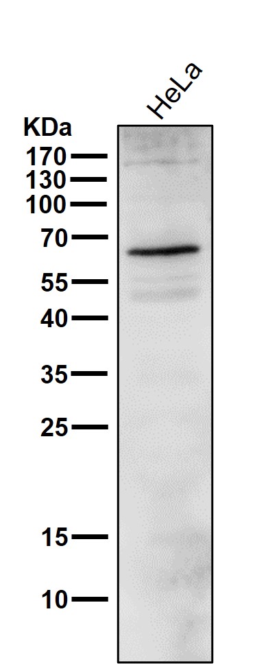 p-Estrogen receptor (S118) Ab