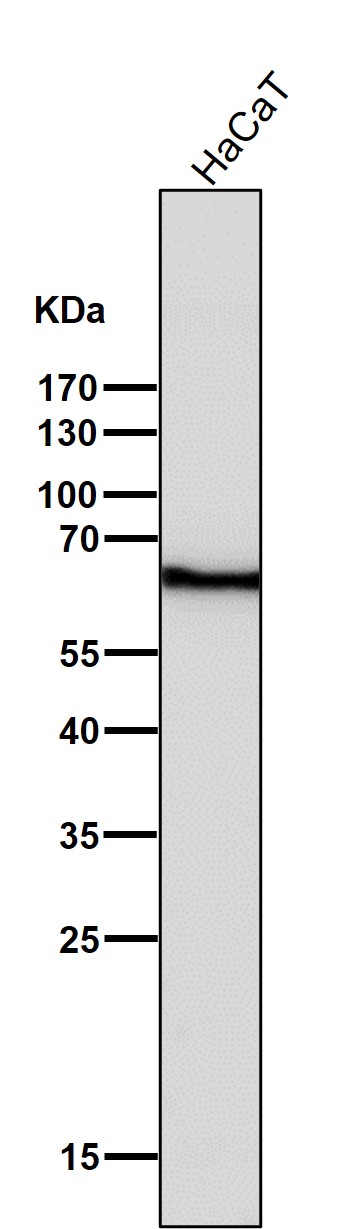 Cytokeratin 5 Ab