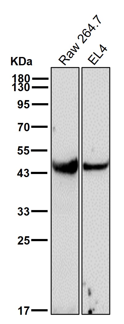 Porphobilinogen deaminase Ab