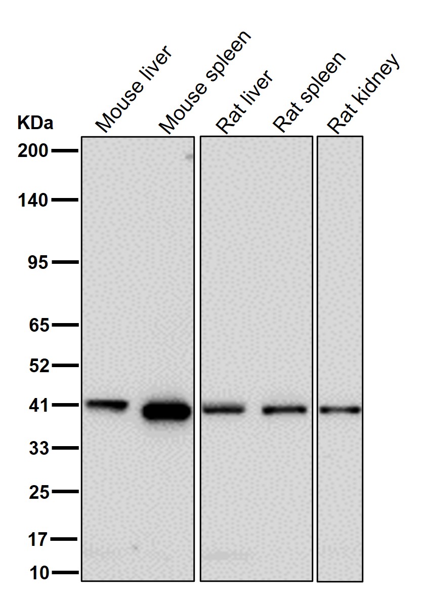 Porphobilinogen deaminase Ab
