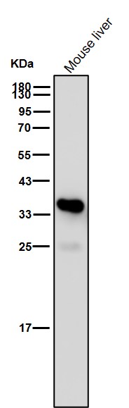 Tryptase 1 Ab