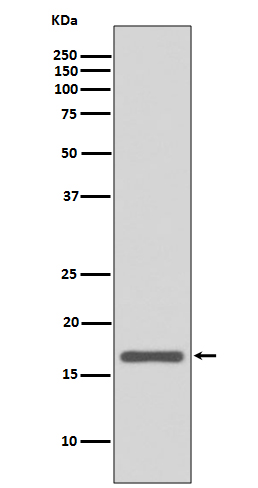 AGR2 Ab