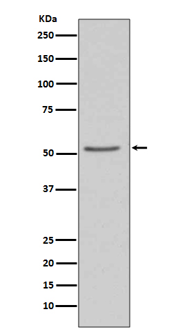 Angiotensinogen Ab