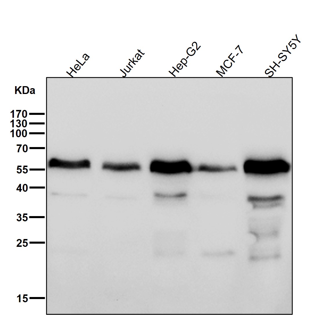 p-SMAD1(S463/S465)/SMAD5(S463/S465)/SMAD9(S465/S467) Ab