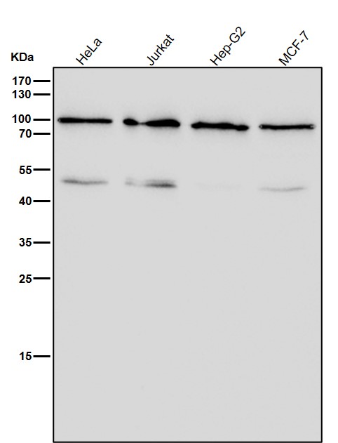 STAT4 Ab
