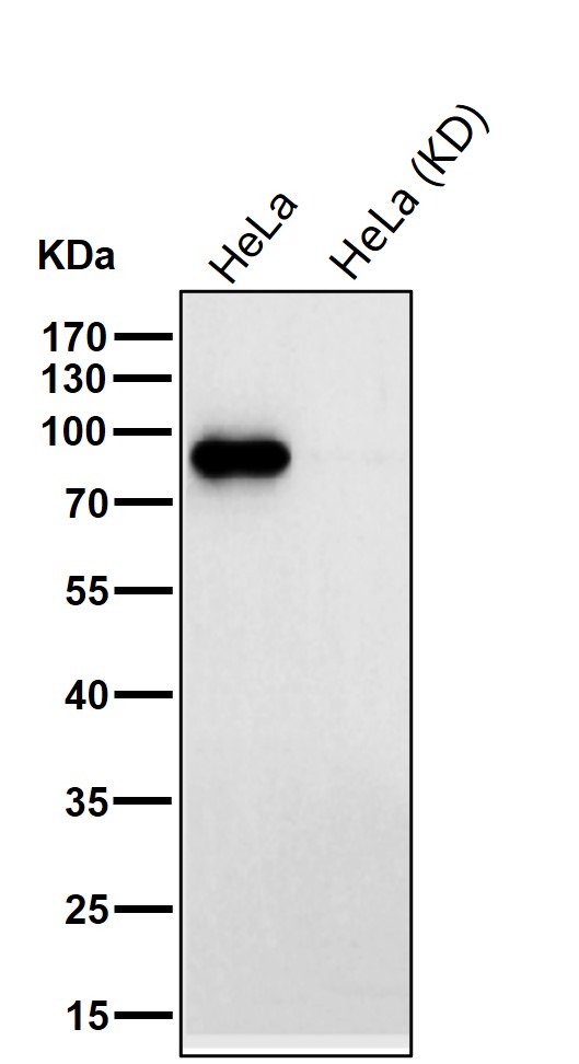 STAT5B Ab