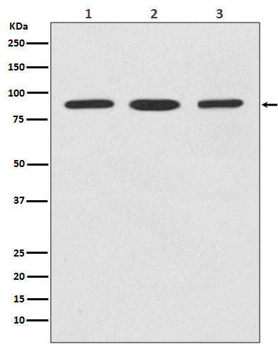 STAT5B Ab