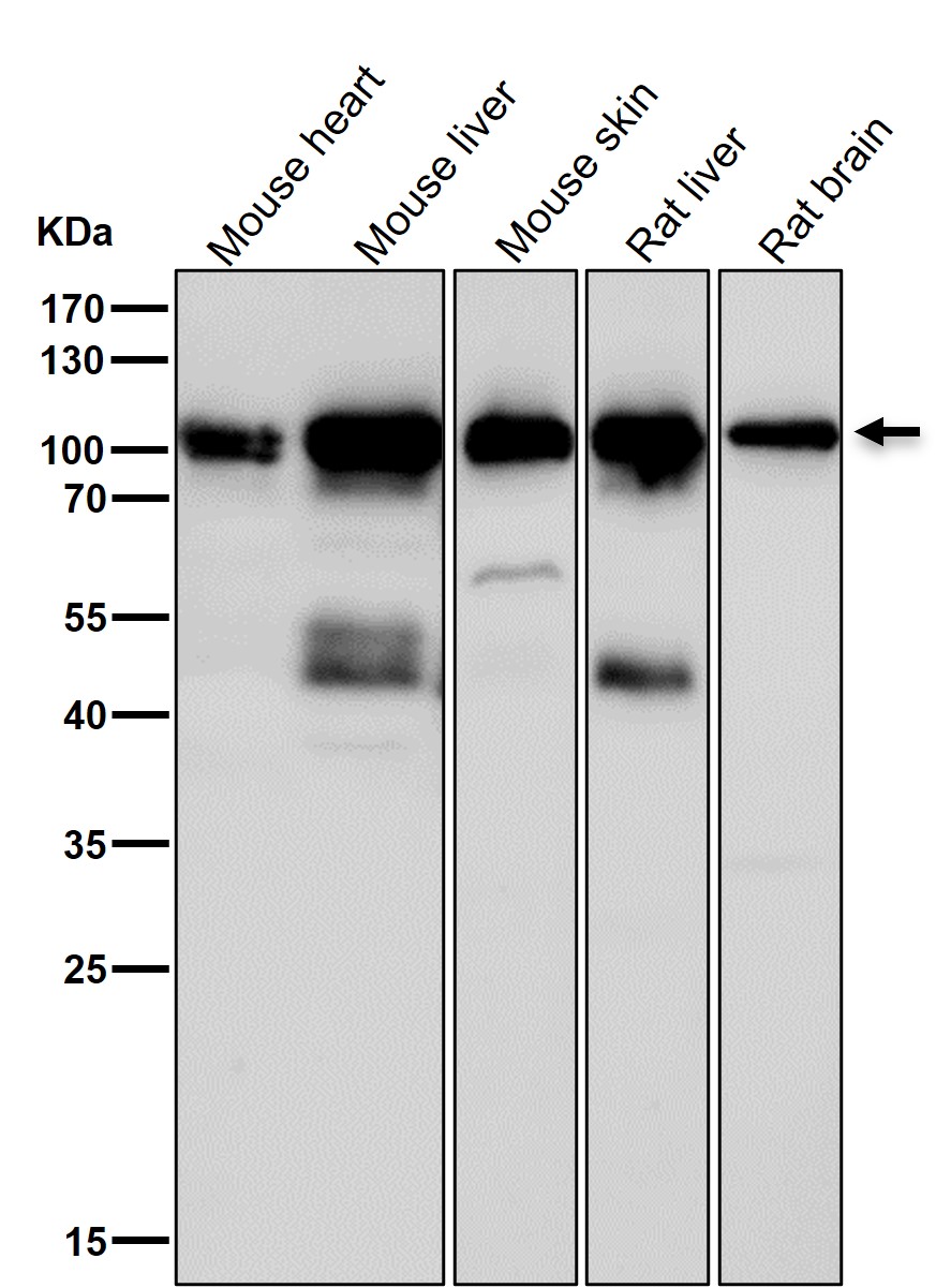 STAT5B Ab