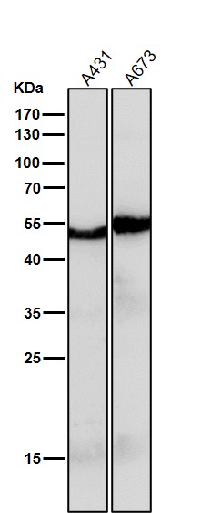 PAX6 Ab