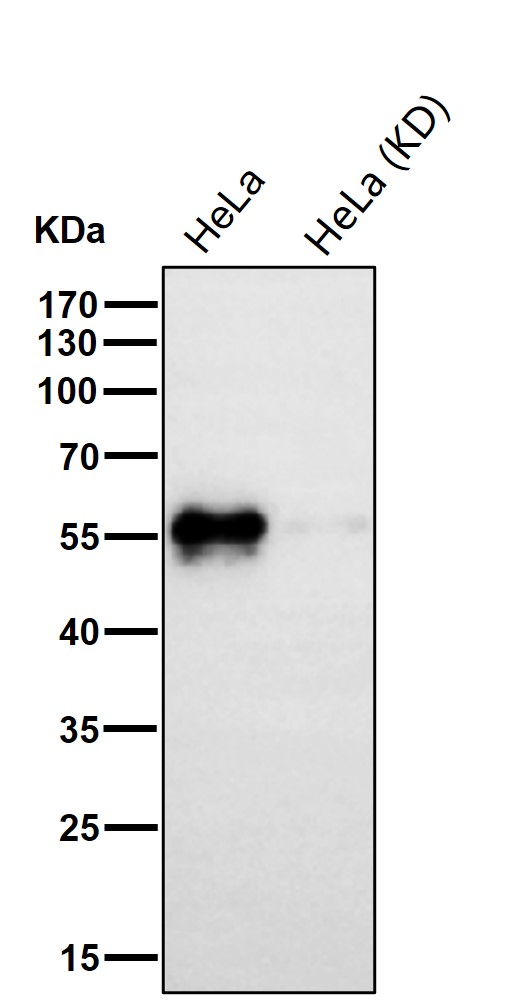 TFG Ab