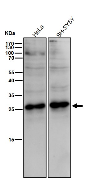 p-Hsp27 (S78) Ab