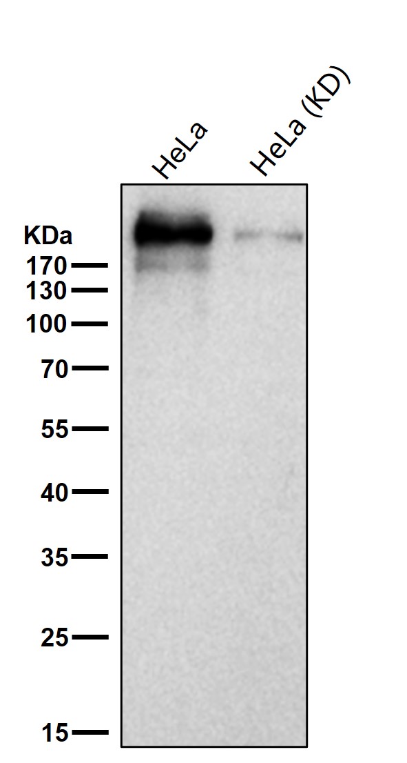 ARID1A Ab
