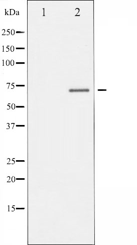 p-Estrogen receptor (S106) Ab