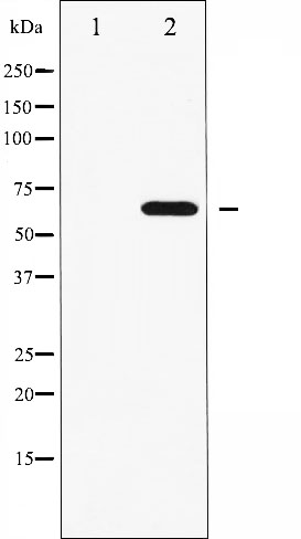 p-FGFR substrate 2 (Y436) Ab