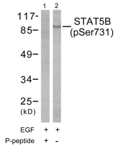 p-STAT5B (S731) Ab