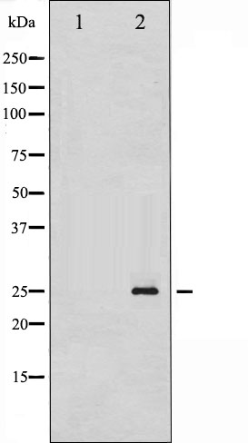 p-Thymidine kinase (S13) Ab
