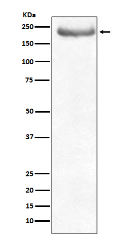 Neurofilament heavy polypeptide Ab