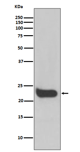 IFN beta Ab
