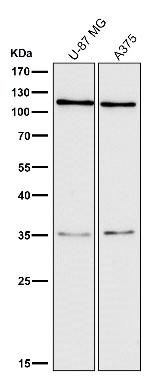 Complement C3 Ab