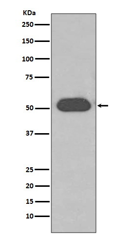 Vitamin D binding protein Ab