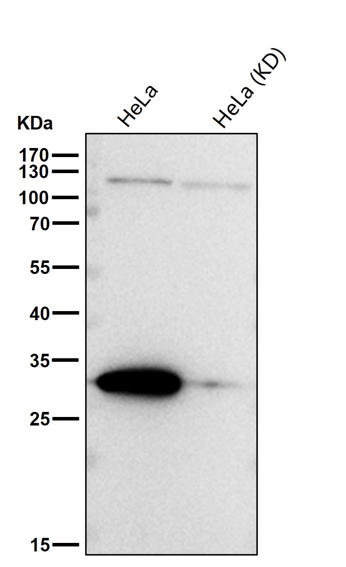 Galectin 3 Ab
