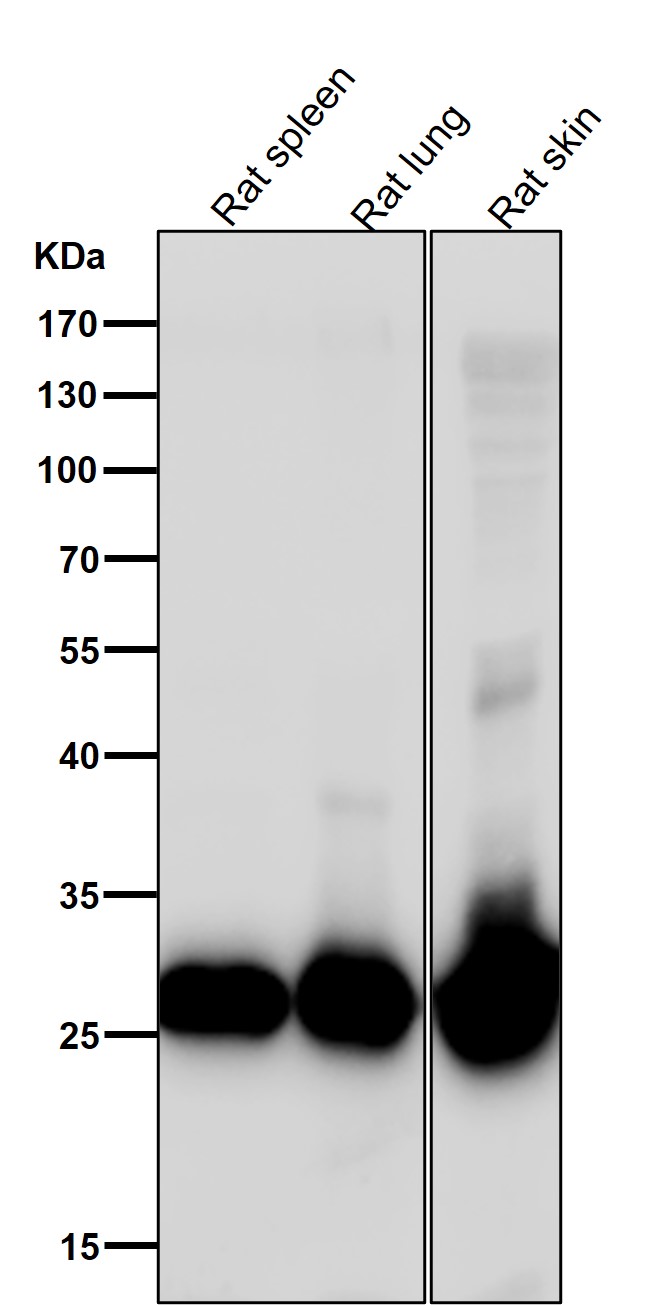 Galectin 3 Ab