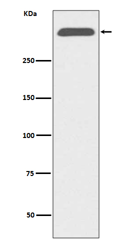 Apolipoprotein B 100 Ab