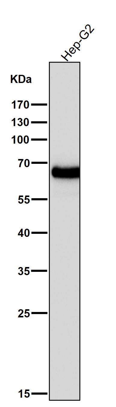 alpha Fetoprotein Ab