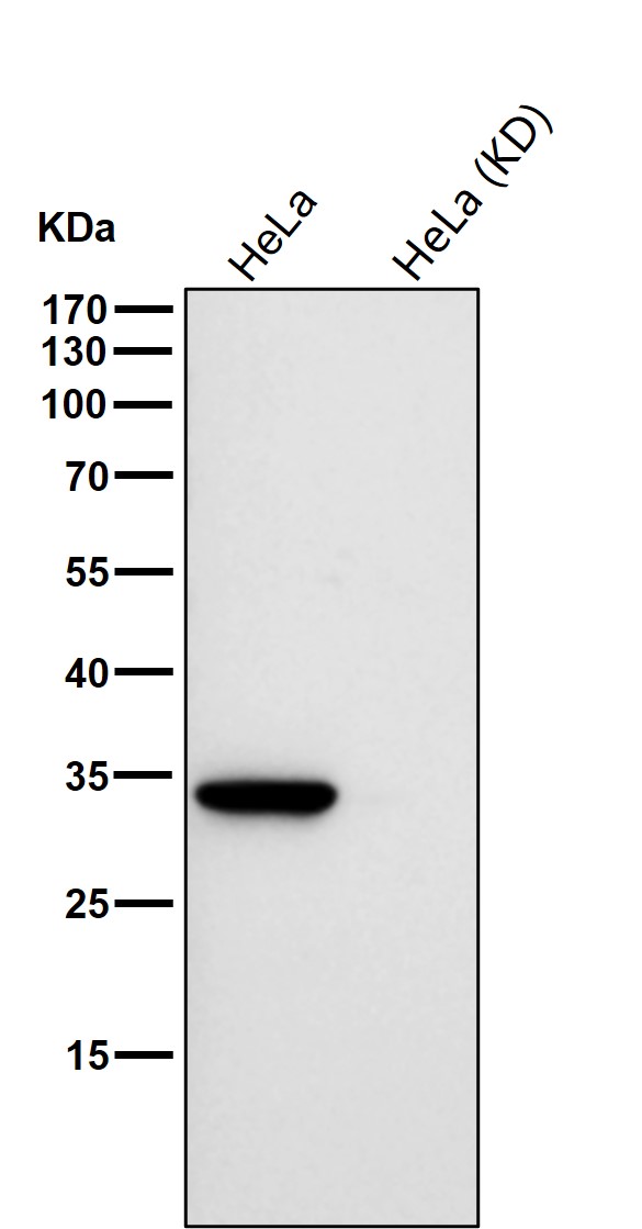 NQO1 Ab