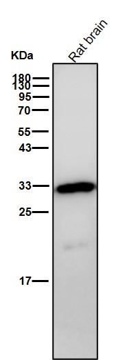 NQO1 Ab