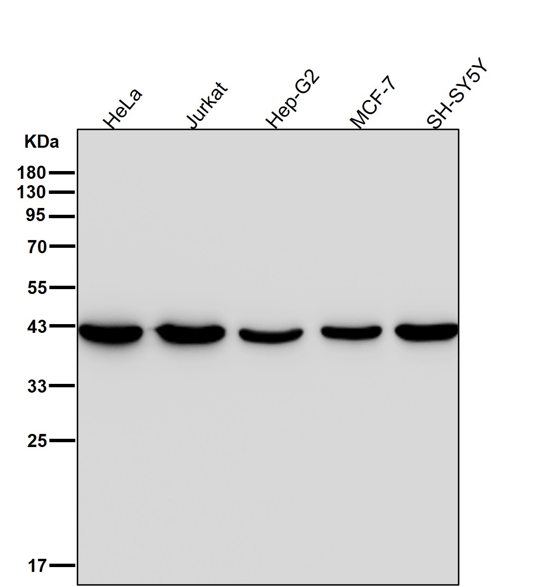 alpha Skeletal muscle actin Ab