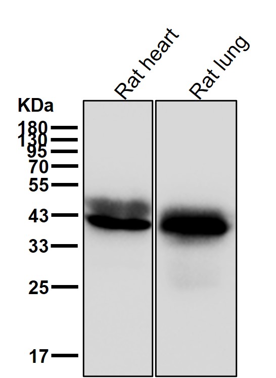alpha Skeletal muscle actin Ab