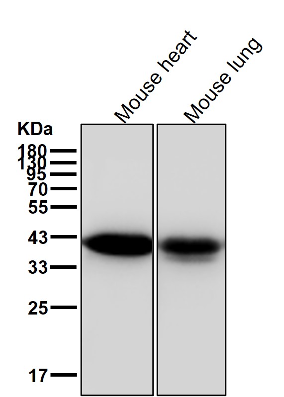 alpha Skeletal muscle actin Ab