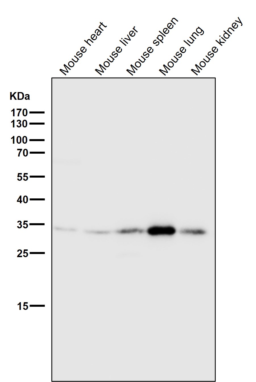 Annexin V Ab