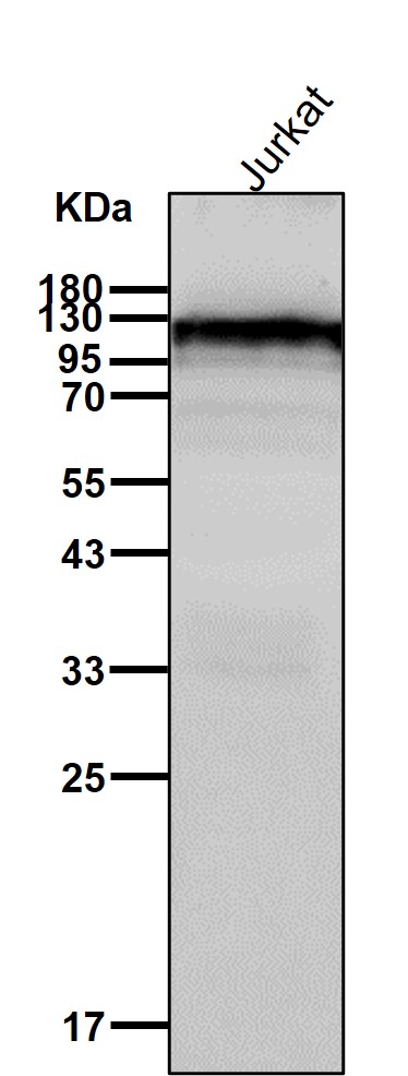 IFN alpha/beta receptor 1 Ab
