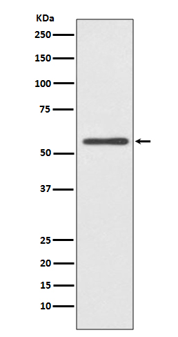 Cytochrome P450 2E1 Ab