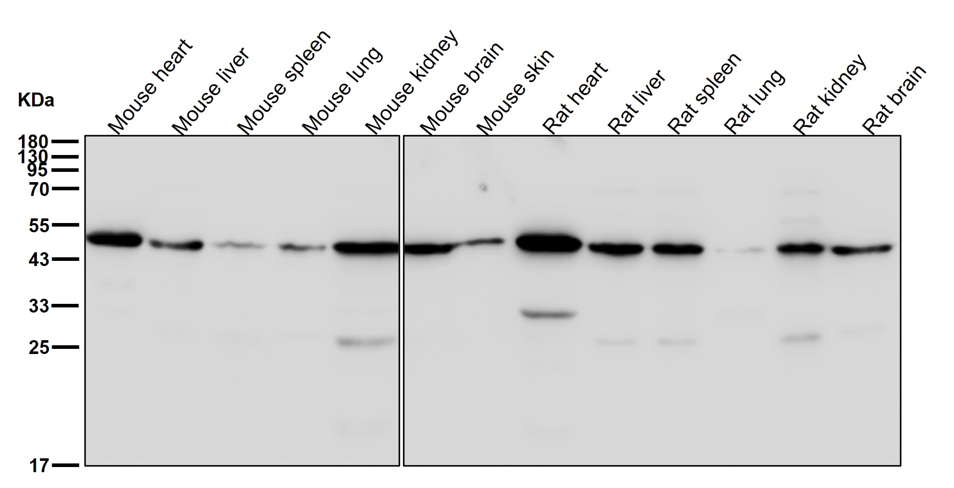 ATP5F1B Ab