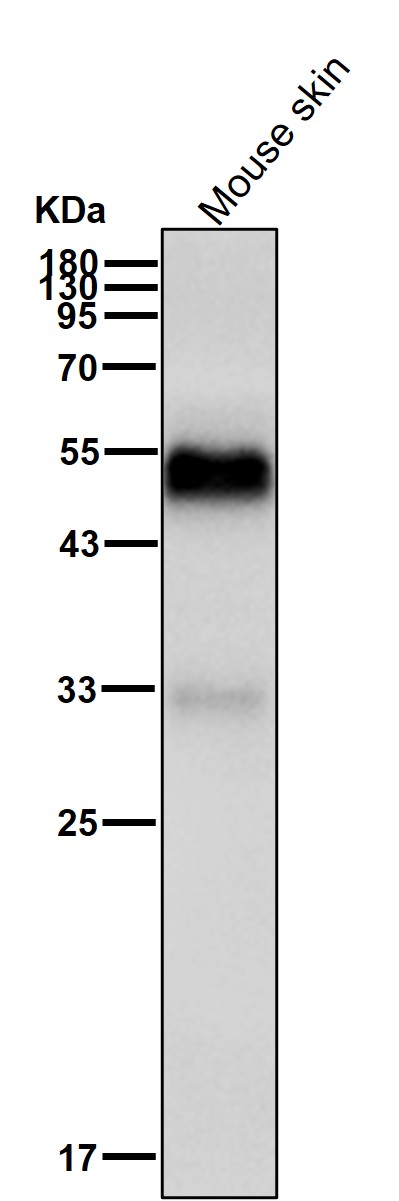Vitamin D3 receptor Ab