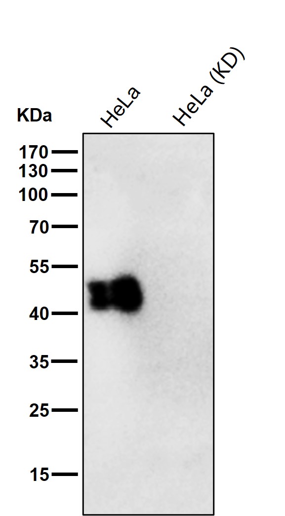 TIA1 Ab