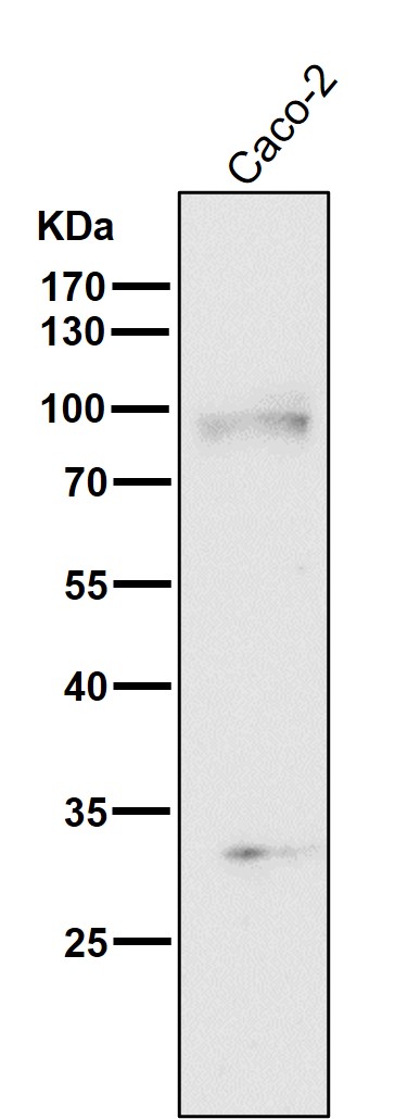 TGFR 2 Ab