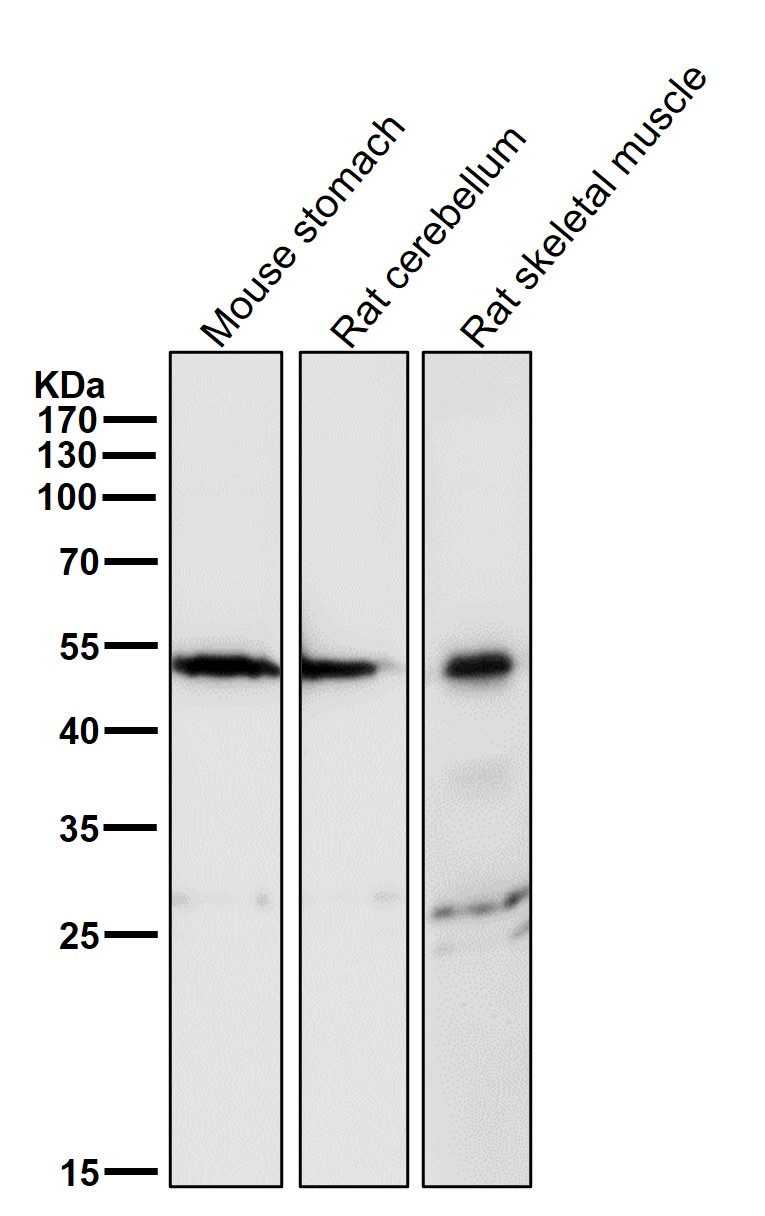 alpha Sarcoglycan Ab