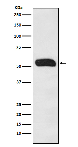 Human IgG Ab