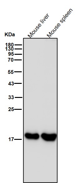 Ferritin light chain Ab