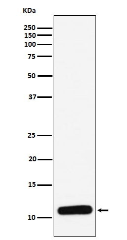 Platelet factor 4 Ab