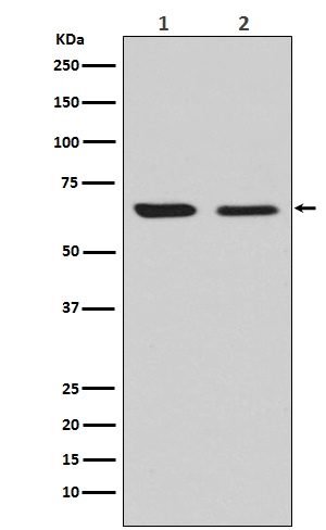DRP 2 Ab