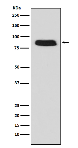 G CSF Receptor Ab