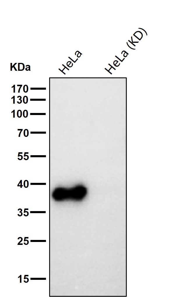 DNA polymerase beta Ab