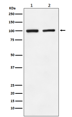 GluR2 Ab
