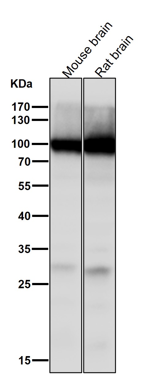 GluR2 Ab