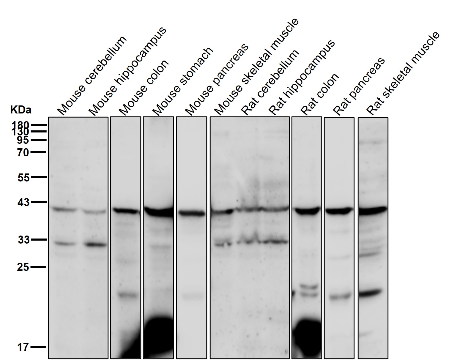 CTLA4 Ab